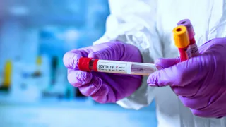 На Брянщине за сутки сделали 2080 тестов на Covid-19